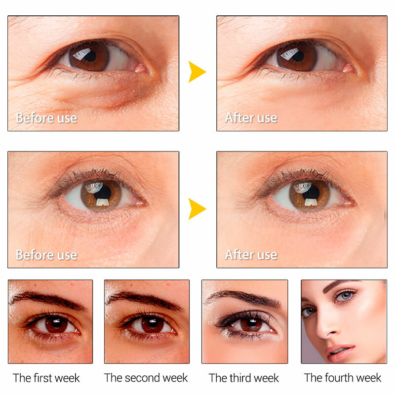 Eye Serum Anti-Aging Wrinkle Soothing Remove Fat Particles Dark Circles Anti-Edema Firming Pulling Hyaluronic Acid Eye Care 20ml