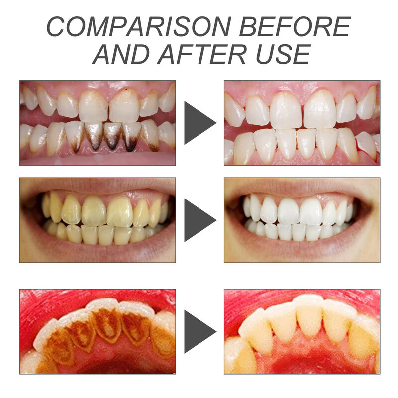 Proszek do wybielania zębów rozjaśniające się żółte zęby usuwają plamę płytki nazębnej higiena jamy ustnej świeży oddech opieka stomatologiczna urządzenia do oczyszczania węgla drzewnego