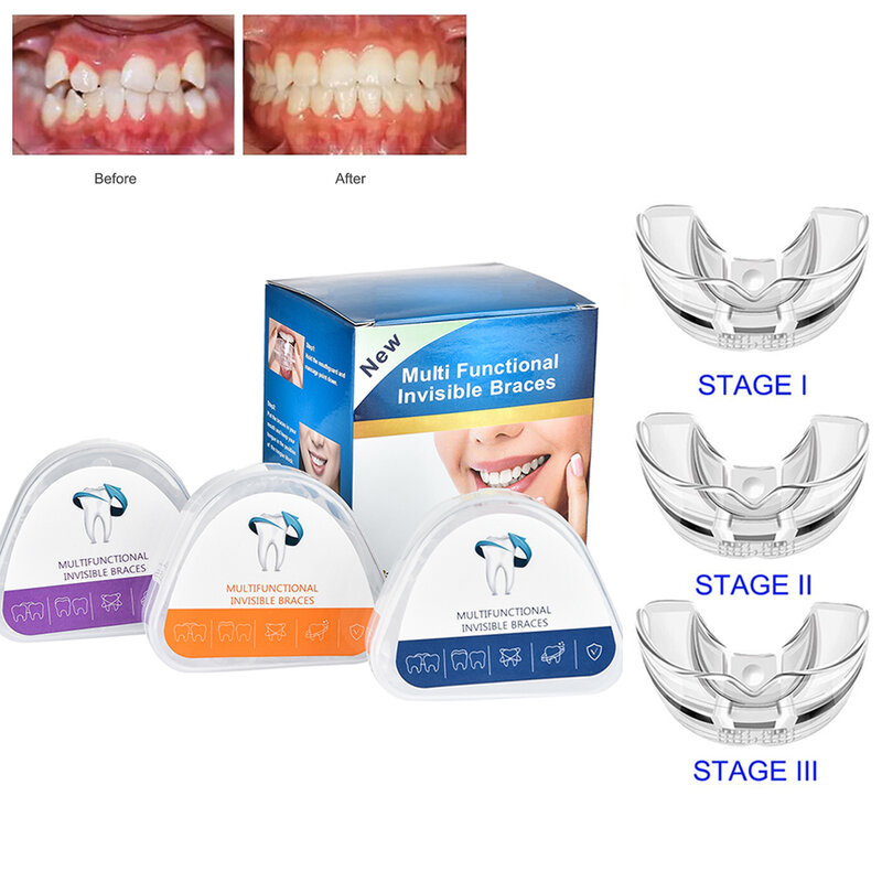 Aparatos dentales de ortodoncia, entrenador de alineación de dientes sonrientes, retenedor de dientes de silicona instantáneo, protector bucal, bandeja de dientes