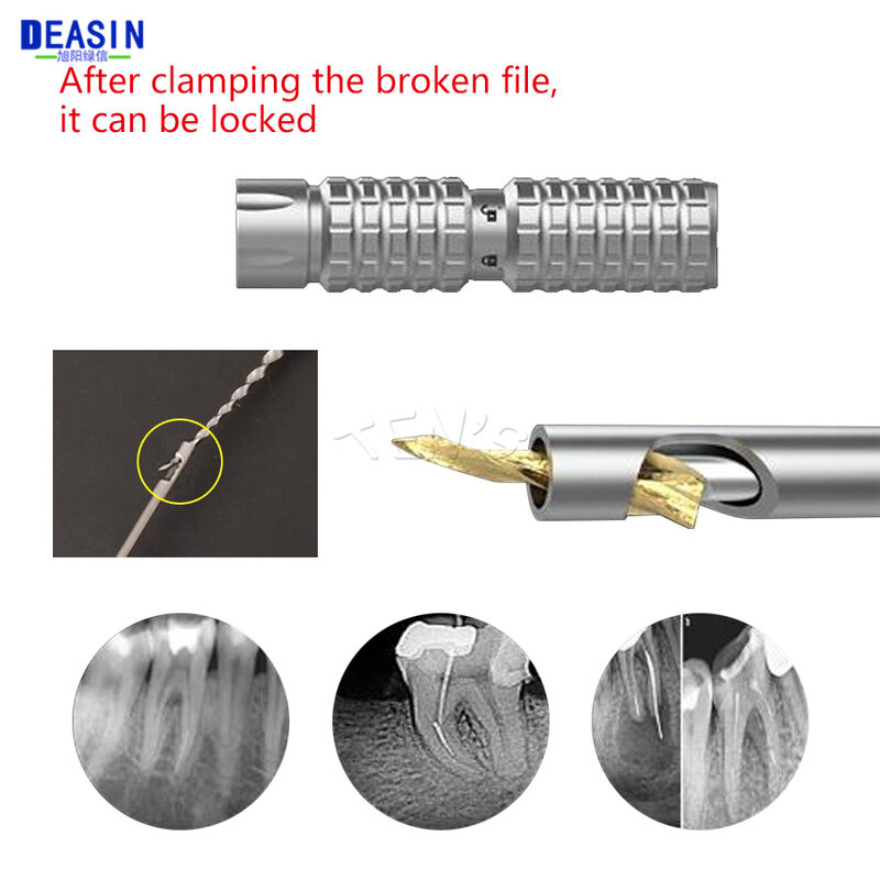 Dental Root Canal Extractor Endodontic Files Extractor Broken File Removal Kit Treatment Broken File Dentistry Tools