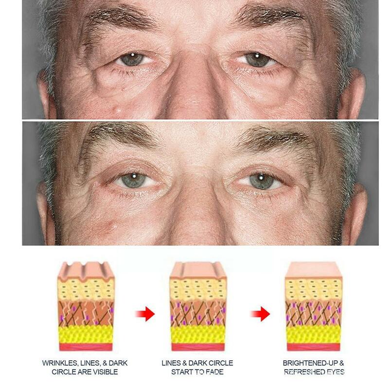 La crema per gli occhi da uomo riduce le rughe degli occhi crema al retinolo borse Anti-prodotto reintegra le rassodazioni degli occhi della pelle elimina la cura dell'acqua Agin H9U7
