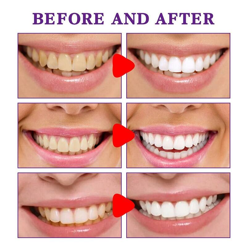 Pasta de dientes blanqueadora V34, Corrector de Color, reparación de limpieza Oral, pasta de dientes, elimina el brillo, esmalte fresco, cuidado de manchas, P4Q4