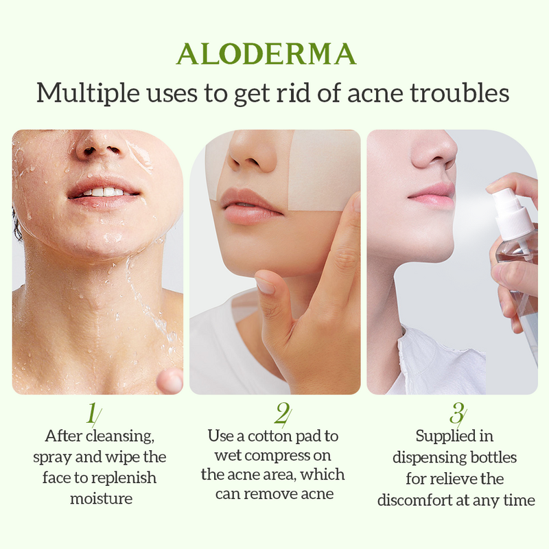 ALODERMA Men-tónico para eliminar el acné de Aloe, controla suavemente el aceite, esencia de agua, Natural, no irritante, calma los poros, 135ml