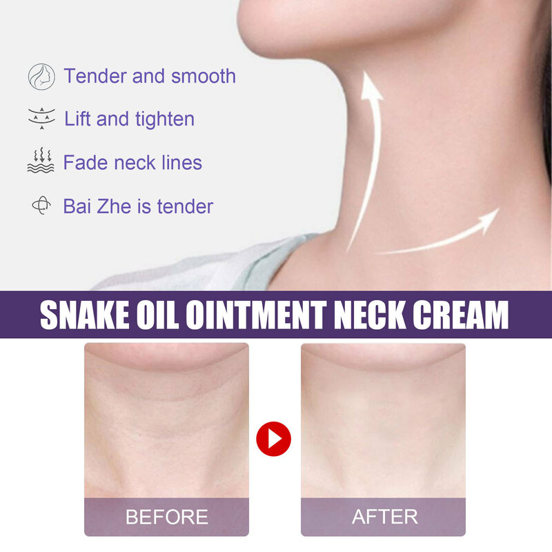 Neck Anti-Wrinkle Cream Eliminate Neck Fine Lines Lift Neck Eliminate Double Chin Moisturiz Nourish Anti-age Firming Skin Care