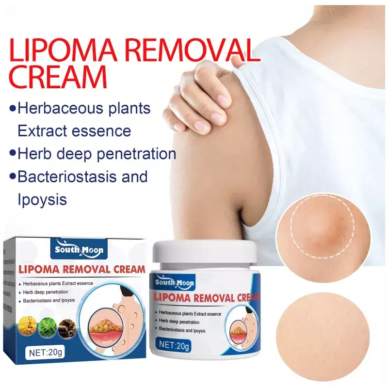Pomada Múltipla para Remoção de Lipoma, Tratamento Celulite Removedor de Fibroma Removedor de Caroços Creme Fat Mass Medicine, 20g
