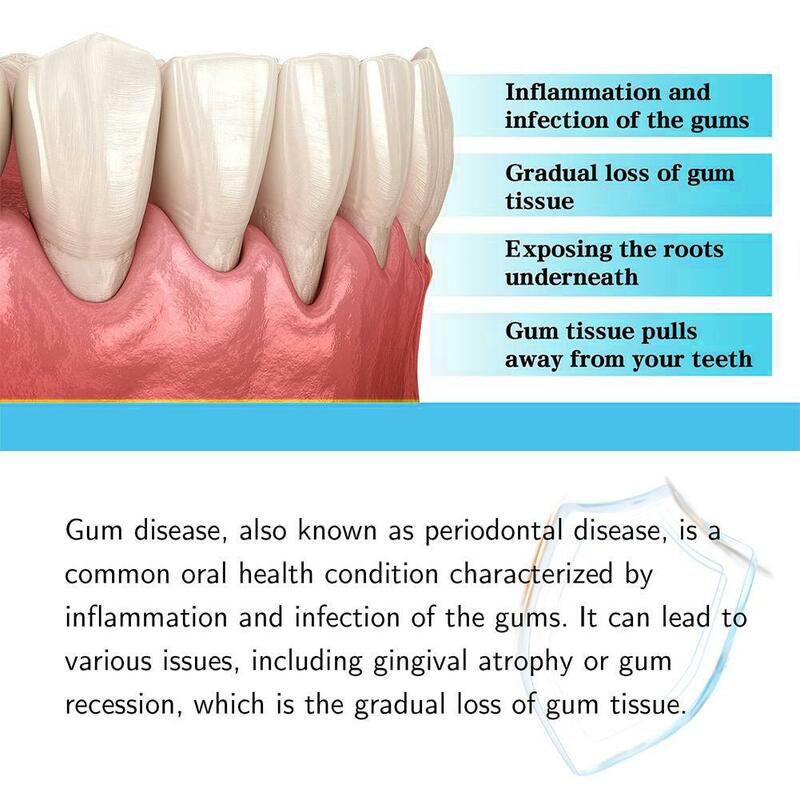 30ML Gum Repair Regrowth Oral Gum Care Liquid For Gum Regrowth Restore Relief Natural Oral Care Drops Relieves Receding Gums