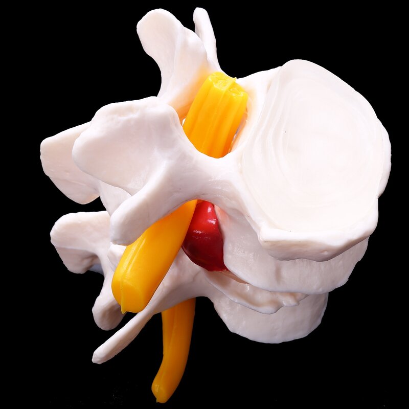 인체 해부학 골격 척추 4 단계 요추 척추 모델, 뇌 두개골 외상 교육 용품