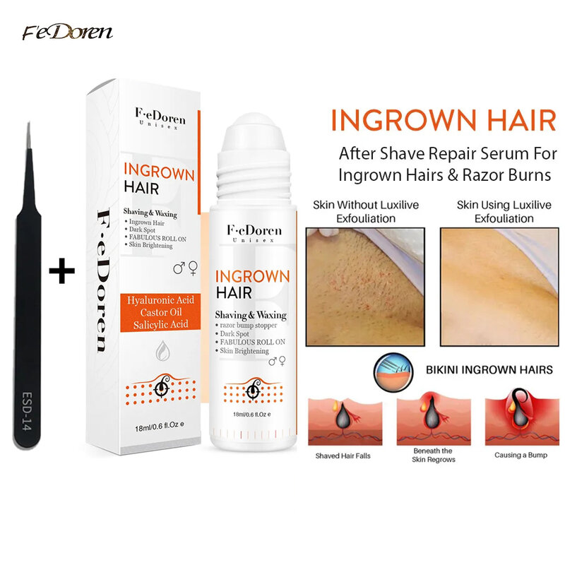 Solución de eliminación de golpes de maquinilla de afeitar, Kit de tratamiento para el cabello Ingrowns, reparación después del afeitado, manchas oscuras, Reduce el enrojecimiento, suero para granos PFB de vanish