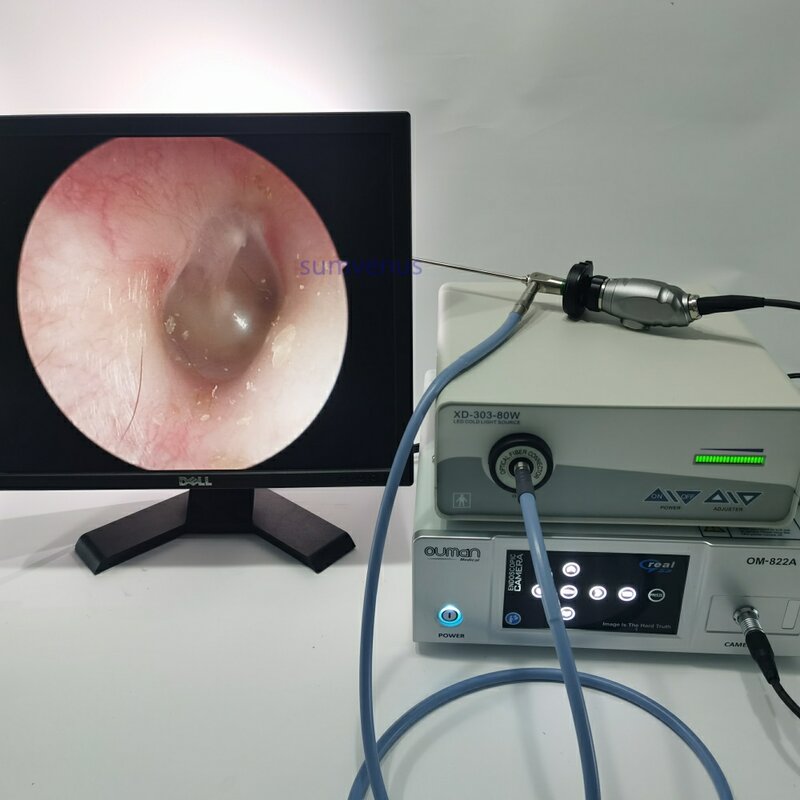 HD 2.7mm 4mm 0 30 45 70 90 degree Medical Surgical Rigid Endoscope Sinusoscope ENT Endoscopy Camera