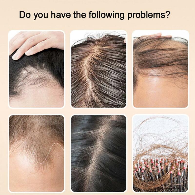 2 torebki do odrastania włosów szampon szybko długie włosy, 100% skutecznie zapobiega wypadaniu ekstraktu, stymuluje włosy silnie odrastają