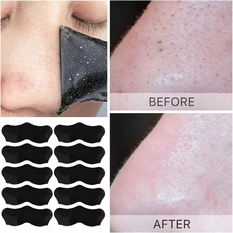 Mascarilla Unisex para quitar espinillas, tiras nasales, Limpieza Profunda, retráctil de poros, pegatinas negras para el cuidado de la piel