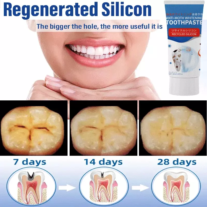 Elimina las cavidades, blanqueamiento dental efectivo, cálculo, placa, Periodontitis