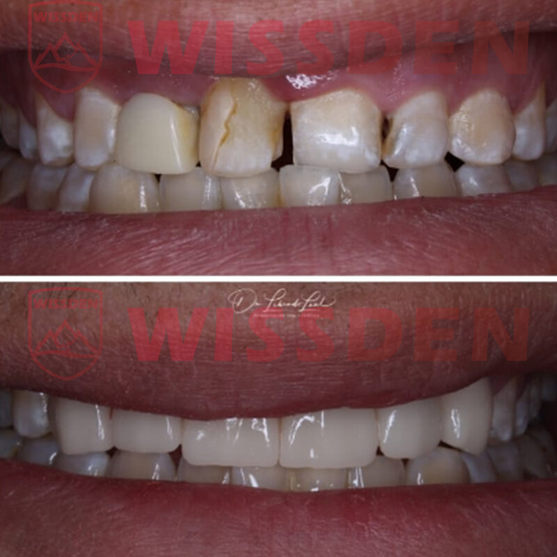 Bloki dikrzemianowe litu 5 szt. C14 kostek szklana ceramiczna dentystycznego Wissden CAD/CAM-natychmiastowa najlepsza informacja zwrotna od klientów na AliExpress