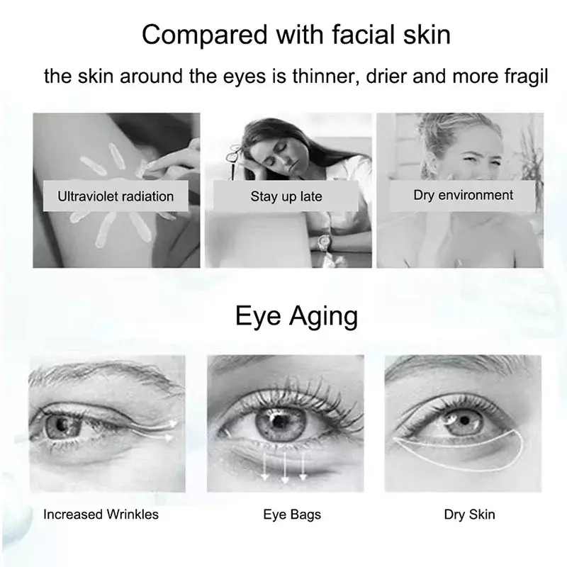 2024 Nicotinamide Eyes Cream Dark Circles Fading Eye Bags Eye Hyaluronic Acid Moisturizing Serum Against Puffiness Eye Care Gel