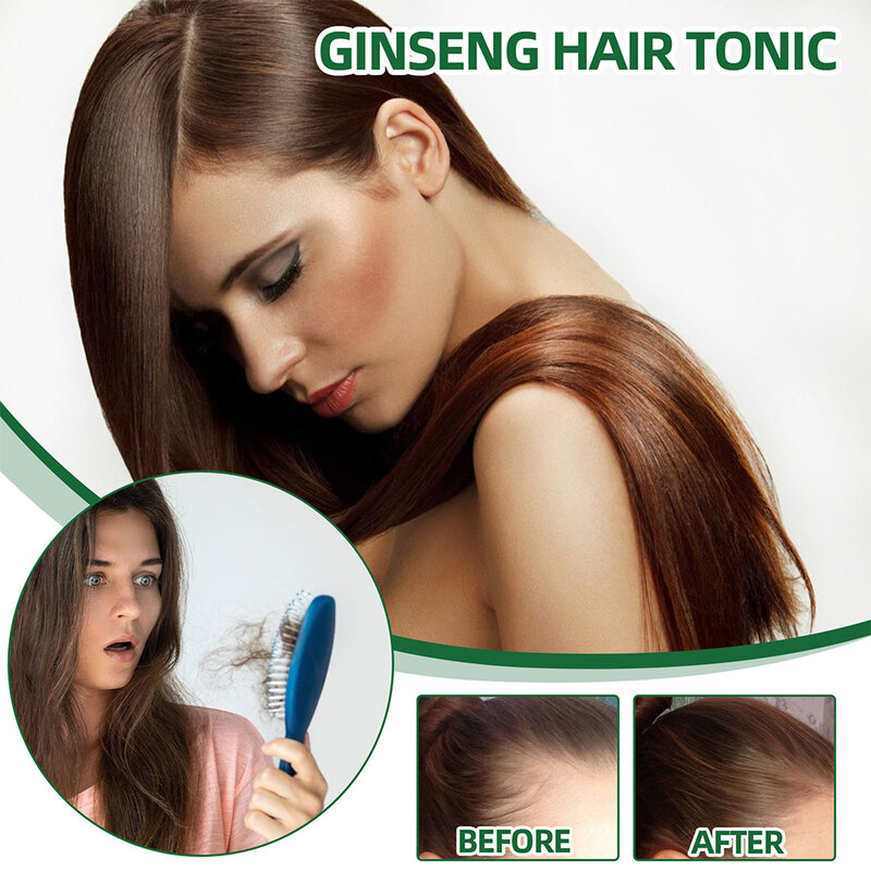 OUHOE minyak Serum penumbuh rambut Ginseng, dengan cairan esensial Biotin memperkuat akar rambut untuk memperbaiki pertumbuhan rambut