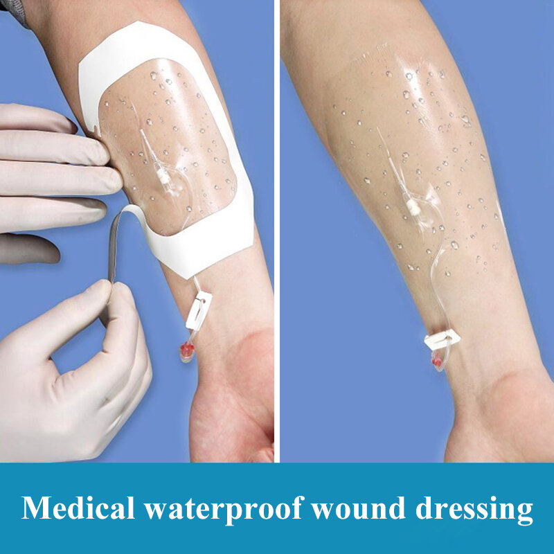 Molho médico impermeável transparente para feridas, Molho de cânula IV auto-adesivo, Inset Needle Fixation Patch, 50Pcs, 10x12cm
