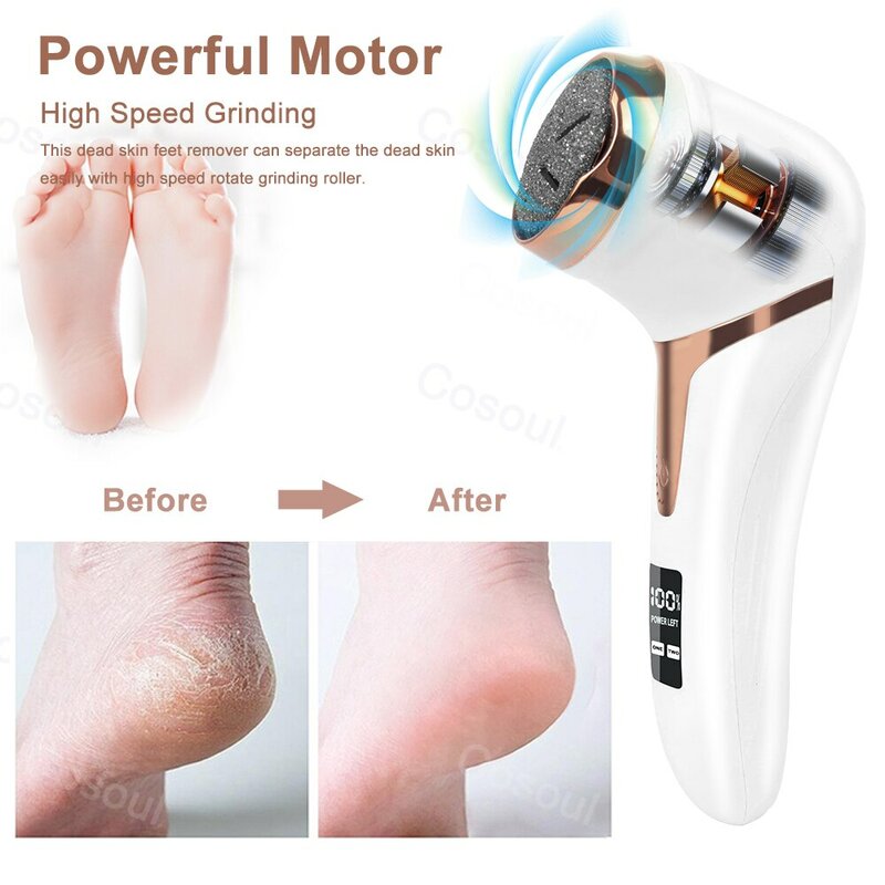 Alat pedikur listrik profesional, penghilang kulit mati kaki, penghilang kalus untuk kikir kaki, penggiling tumit Eksfoliasi