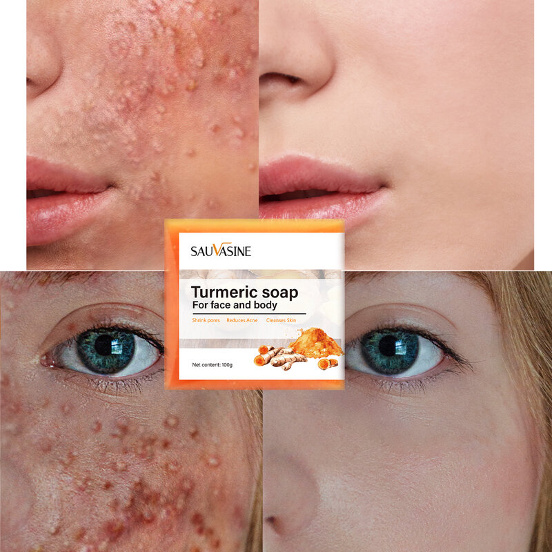 Turmeric Soap Face Cleansing Anti Acne Skin Brighten Remove Pimples Dark Spot Lightening Ginger Essential Oil Body Bath