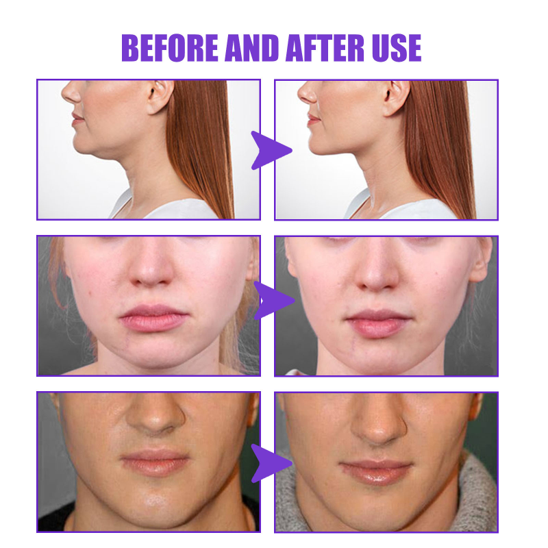 V Shape Slimming Cream Face-lift Removal Double Chin Firming Tighten Mandibular line Slimming Muscle Fat Burning Cream 30g