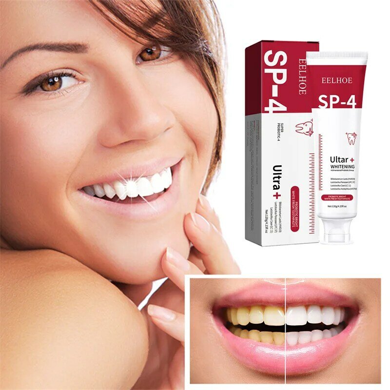 Pasta de dientes probiótica Sp-4, pasta de dientes blanqueadora, brillo, protege las encías, respiración fresca, limpieza bucal, cuidado de la salud dental, 120g