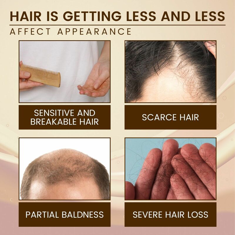 Hair Growth Oil Regrowth Dense Repair Baldness Hereditary Loss Dry Damaged Strengthening Smooth Nourishing Scalp Treatment Serum
