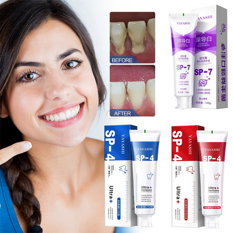 معجون أسنان بروبيوتيك SP-4 ، اشراق ، تبييض ، حماية اللثة ، التنفس النقي ، الفم ، تنظيف الأسنان ، الصحة ، العناية بالفم ، 120 جرام