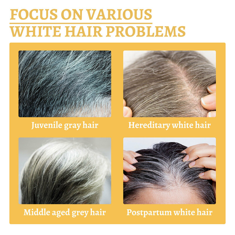 Grijs Wit Haar Behandeling Serum Vloeibaar Wit Tot Zwart Natuurlijke Kleur Reparatie Voedt Producten Anti Verlies Haarverzorging Voor Mannen Vrouwen
