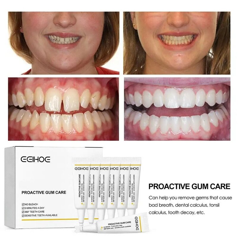 Bescherm Kauwgomserum Anti Ontsteking Elimineert Tandplak Reparatie Tanden Tandvlees Essentie Witter Tandvlekken Calculus Re C7o9