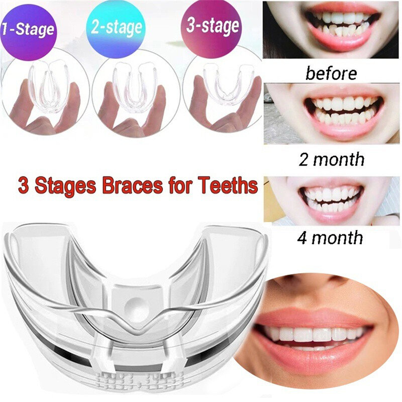 Силиконовые невидимые Ортодонтические зубные приборы, 3 этапа, Защита рта, подтяжки, лоток для зубов, инструмент для ухода за зубами