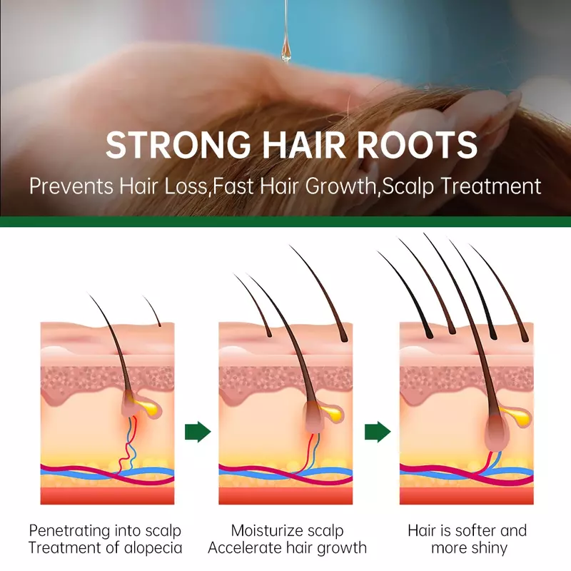 Óleo essencial de alecrim para homens e mulheres, cuidado capilar, produto de crescimento, para tratamento do couro cabeludo, tratamento da raiz do cabelo, 50ml