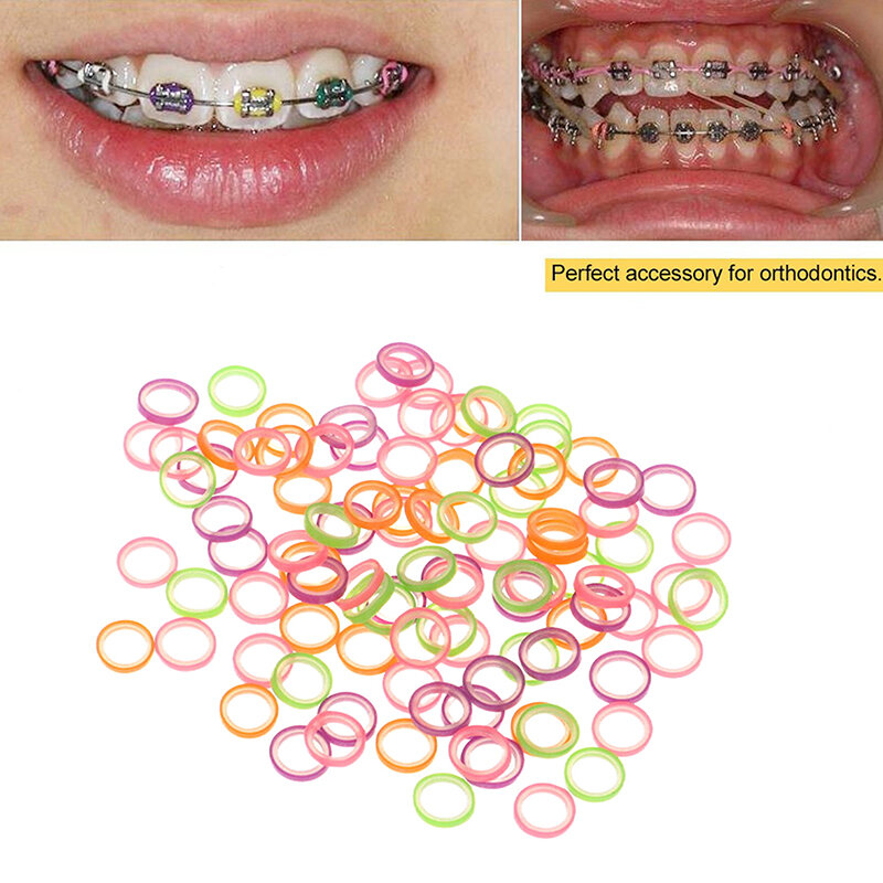 Elastic Rubber Dentes Traction Rings, Orthodontics Band, Ferramentas Dentistas Misturadas, Laboratório Odontológico, Acessórios de Odontologia, 100Pcs