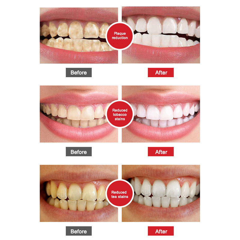 ยาสีฟันโปรไบโอติก SP-4ความกระจ่างใสยาสีฟันสูตรฟันขาวปกป้องเหงือกจากลมหายใจสดชื่นทำความสะอาดฟันการดูแลสุขภาพช่องปาก