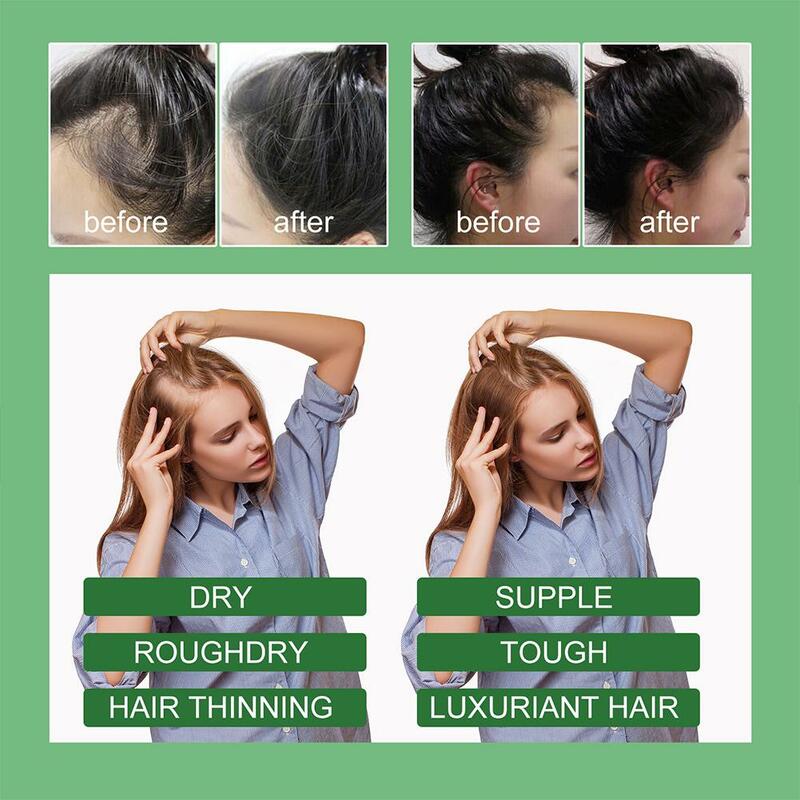 2/4x Rosmarin Haarpflege ätherisches Öl pflegt Haarwurzeln, repariert Gabelung und Haars chäden, glattes Haar nährt Haarpflege oi