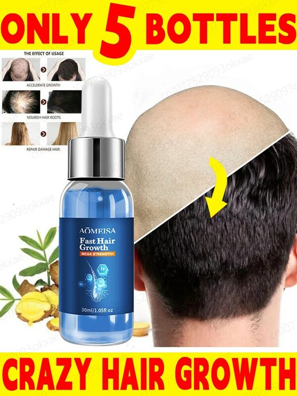 Быстродействующие и эффективные продукты с эфирным маслом для роста волос Лечение выпадения волос Предотвращение наследственной себорейной алопеции для мужчин и женщин