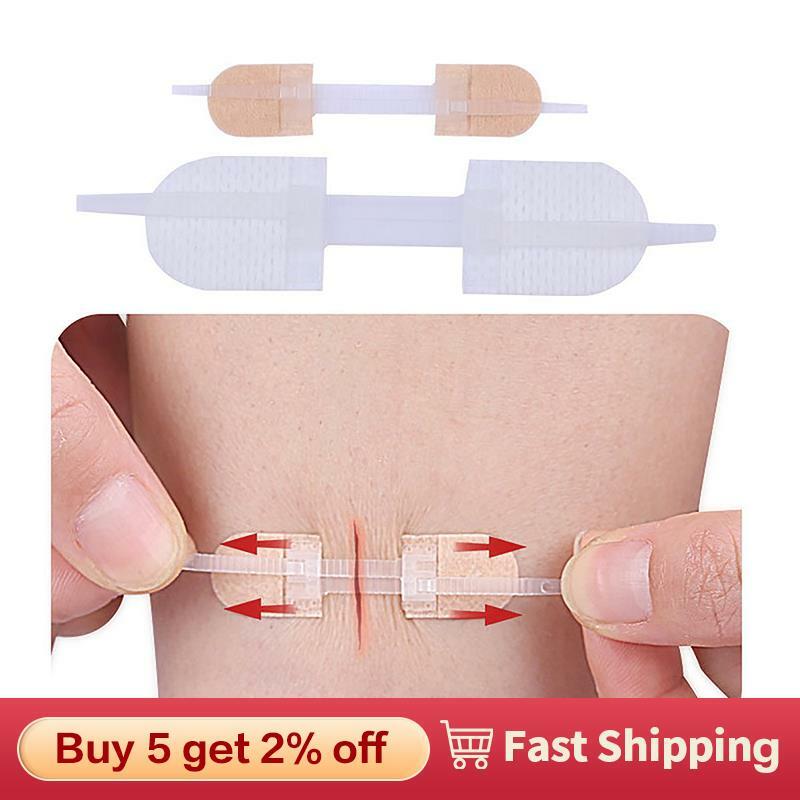 Band-Aid ritsleting dasi penutup luka Patch hemostatik Patch luka cepat menjahit ritsleting Band-Aid luar ruangan portabel