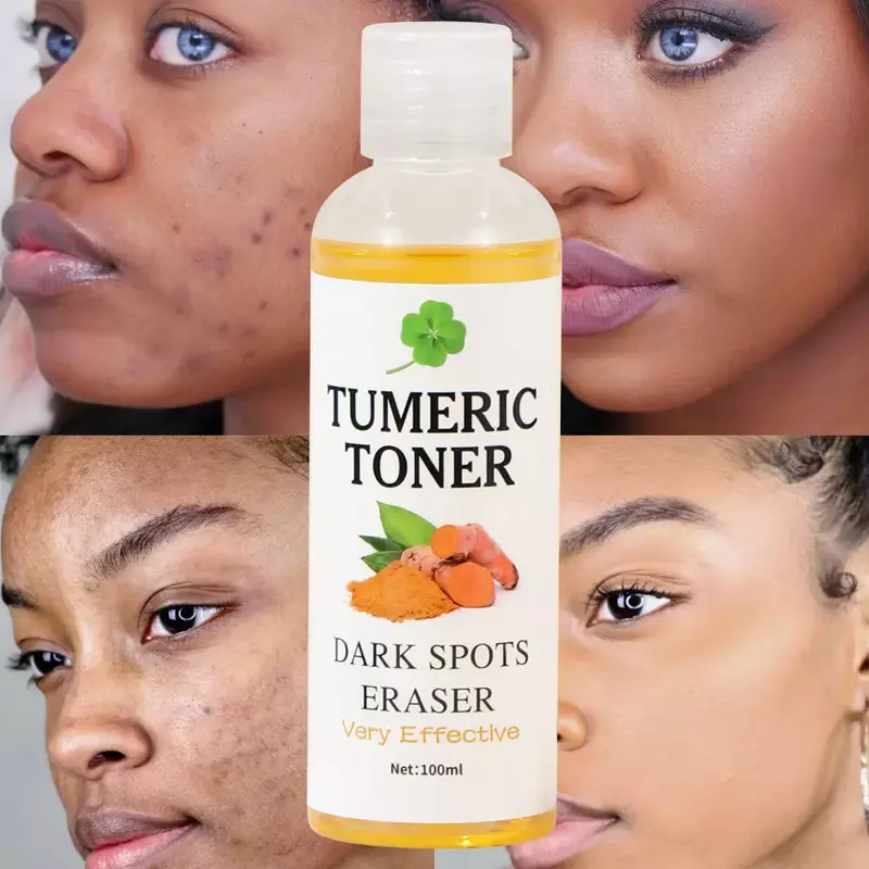 100mL Dark Spots Eraser Turmeric Toner Softening lotion removing black turmeric toner skin care products Facial care