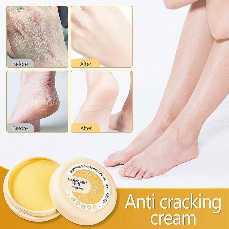 20g Anti-Drying Crack Foot Cream Heel Cracked Repair Mask Care Cream Cream Dead Skin Foot Removal Hand Q3I7