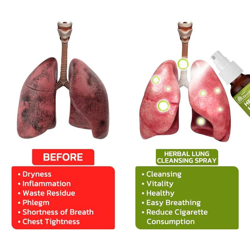 Spray de limpieza de pulmones Herbal, Desintoxicación de aliento, Spray de limpieza de pulmones Herbal, vapor de limpieza de pulmones Herbal, potente soporte de pulmones, 1, 2, 3, 5x