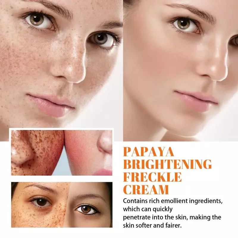Papaya Whitening Freckle Cream, Eficaz Fade Facial, Melasma Dark Spots, Melanina, Anti-Aging, Iluminar Hidratante, Cuidados com a pele