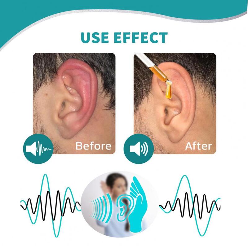 10ml Functional Tinnitus Relief Ear Drops Tinnitus Treatment Liquid Lightweight  Anti-allergy