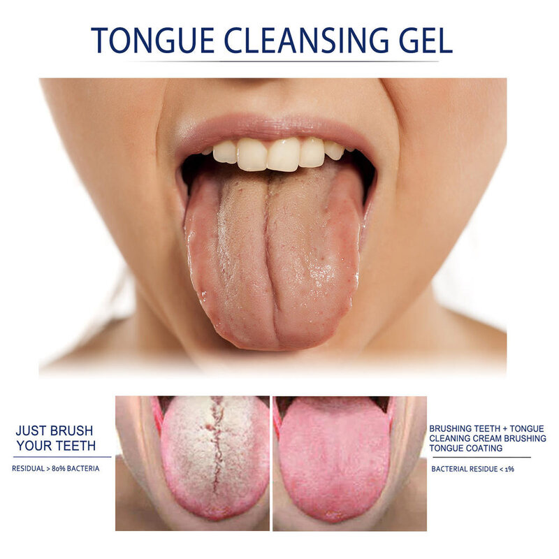 Gel de limpeza de língua com escova, higiene bucal, remover o mau hálito, hálito fresco, bpa livre, para mulher e homem