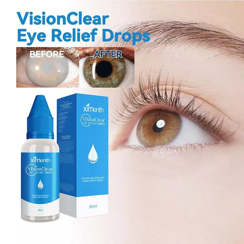 20ml Eye Drops To Improve Eyesight Relieve Eye Fatigue Redness Blurred Vision Discomfort Treatment Antibiotic Liquid