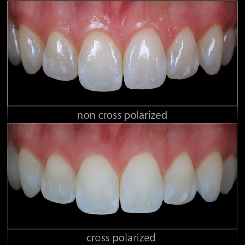Dental Cruz Polarização Photo Kit para Dentista, Flash, Sem Brilho, MF12, Sem Reflexões