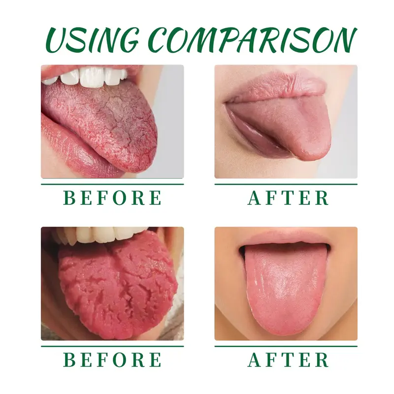Fissured Tongue Relief Spray Relieve Dry Crack Swell Tongue Eliminate Mouth Bacteria Remove Bad Breath Portable Mouth Care Spray