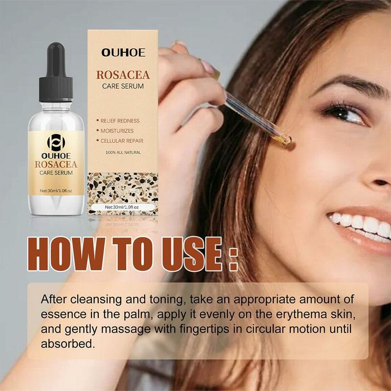 Rosacea-Sérum réparateur pour la peau, essence réparatrice d'érythème, apaisant et hydratant, soin du visage, 30ml
