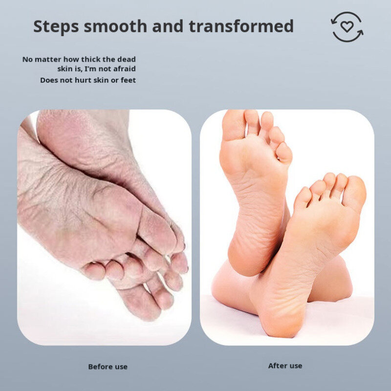 Household electric pedicure feet goodbye calluses automatic foot greeting machine