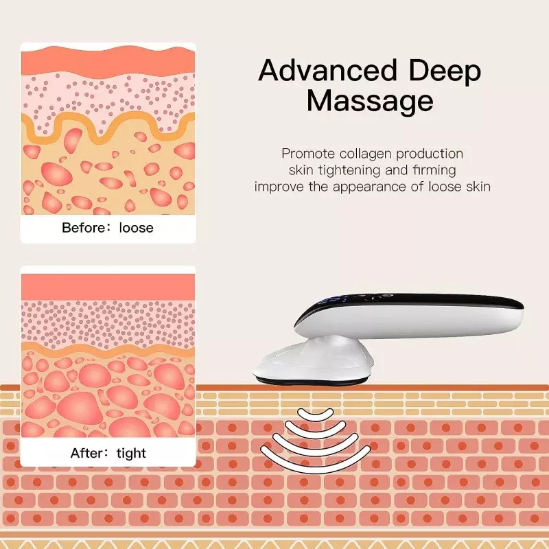 Electric deep Tissue and Cellulite Remover Massager for Belly Legs Arms Body Sculpting Machine