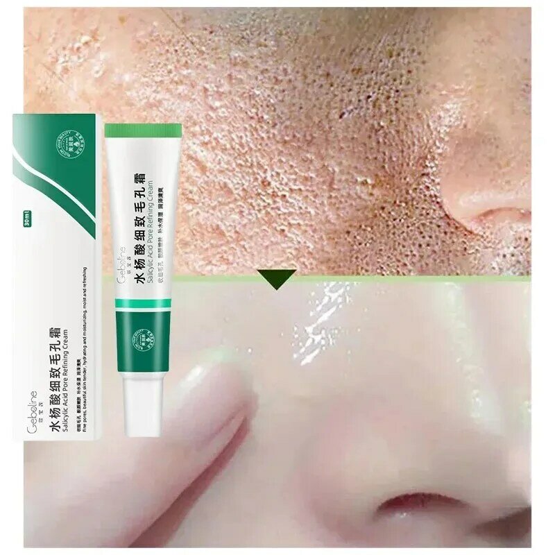Salicylic Acid Shrink Pore Cream Elimination Large Pores Quick Remove Blackehead Tighten Face Smooth Repairing Skin Care Product
