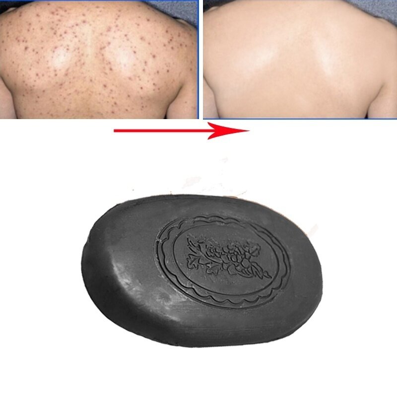 Jabón de lavado de carbón de bambú para eliminar el acné corporal, limpieza de cara y cuerpo, cuidado de la piel