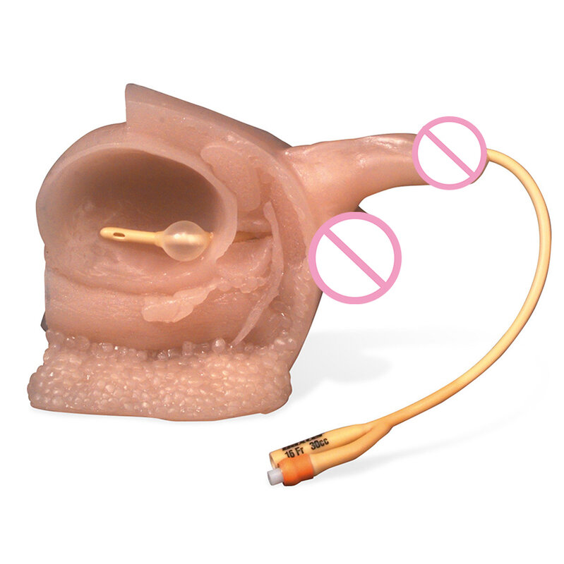 Dilatador de sonido para el pene, dilatador de la vejiga con sonido uretral, SONDA DE Uretra